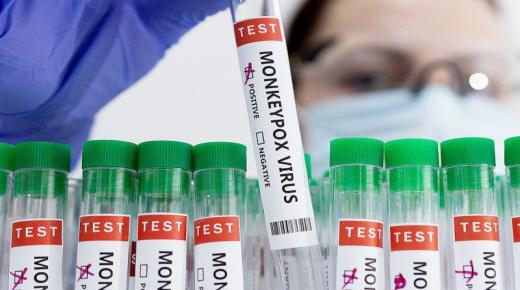 الخوف من «جدري القرود» يستأثرُ بـ«الاهتمام»